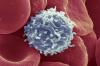Los científicos han encontrado una manera, haciendo que las células T para comenzar a combatir el cáncer