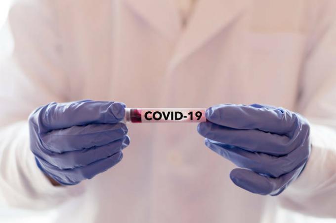 Confirmada nueva forma de infección por coronavirus