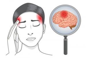 7 tipos de dolores de cabeza: lo que dice la localización que tratar específicamente