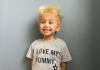 Niño diente de león: ¿Qué es el síndrome del cabello despeinado?