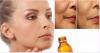 Cómo utilizar aceite de almendras para la belleza y juventud de la piel