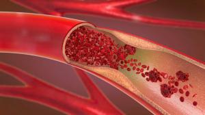 Cómo fortalecer los vasos sanguíneos: TOP-4 formas