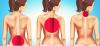 ¿Cómo deshacerse del dolor de espalda con el ejercicio