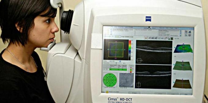 Angiografía por tomografía de coherencia óptica