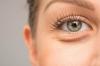 Bolsas bajo los ojos: esteticistas aconsejan cómo deshacerse