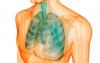 Enfermedad pulmonar que se arrastra para arriba desapercibido