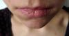 ¿Qué tan fácil a los labios agrietados de curación