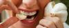 7 maneras de cómo deshacerse del olor de la boca de ajo