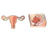 ¿Qué ocurre con el útero antes y después del parto: estudio de lo que se necesita