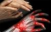 Síntomas y causas de la artritis reumatoide como advertir
