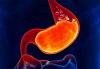 Usted gastritis: 6 signos no evidentes