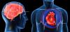 Infarto de miocardio y accidente cerebrovascular: 7 grandes errores que provocan