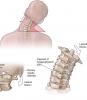 4 ejercicios básicos para la columna cervical ayudarán a olvidar el dolor y osteocondrosis!