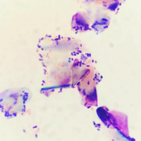 El hongo Malassezia. muchas variedades de dermatitis asociados a ella. Pero eso es un tema aparte para la discusión