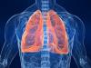 Los fumadores: cómo limpiar los bronquios, pulmones?