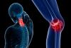 5 señales de que usted tiene osteoporosis comienza
